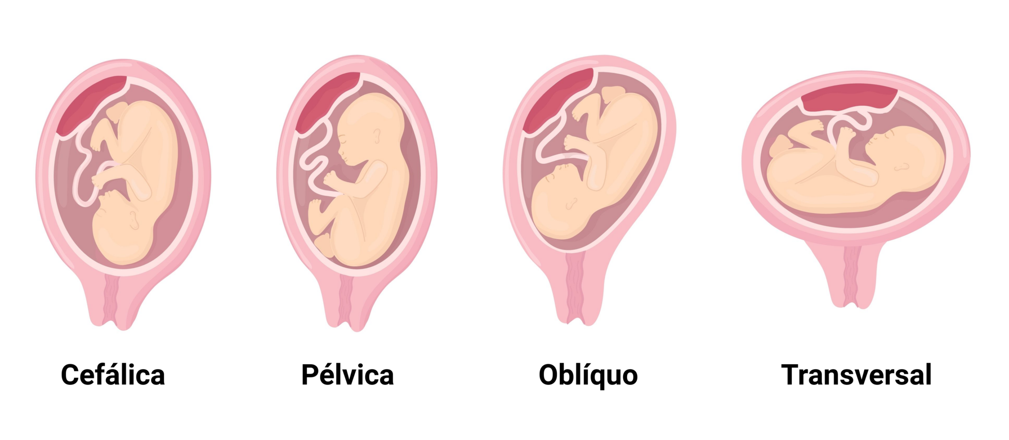 O Formato Da Barriga Na Gravidez Pode Indicar O Sexo Do Beb Vitat