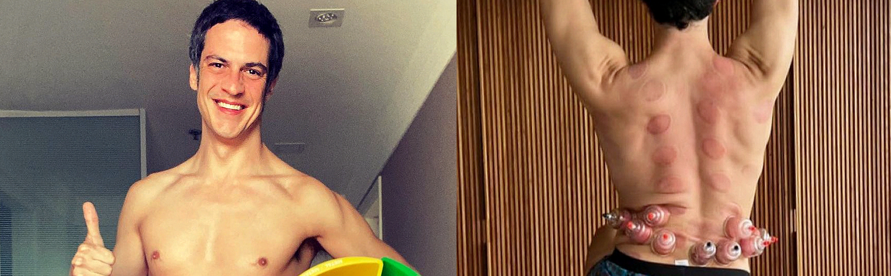 Ventosaterapia: Mateus Solano faz tratamento que promove relaxamento muscular