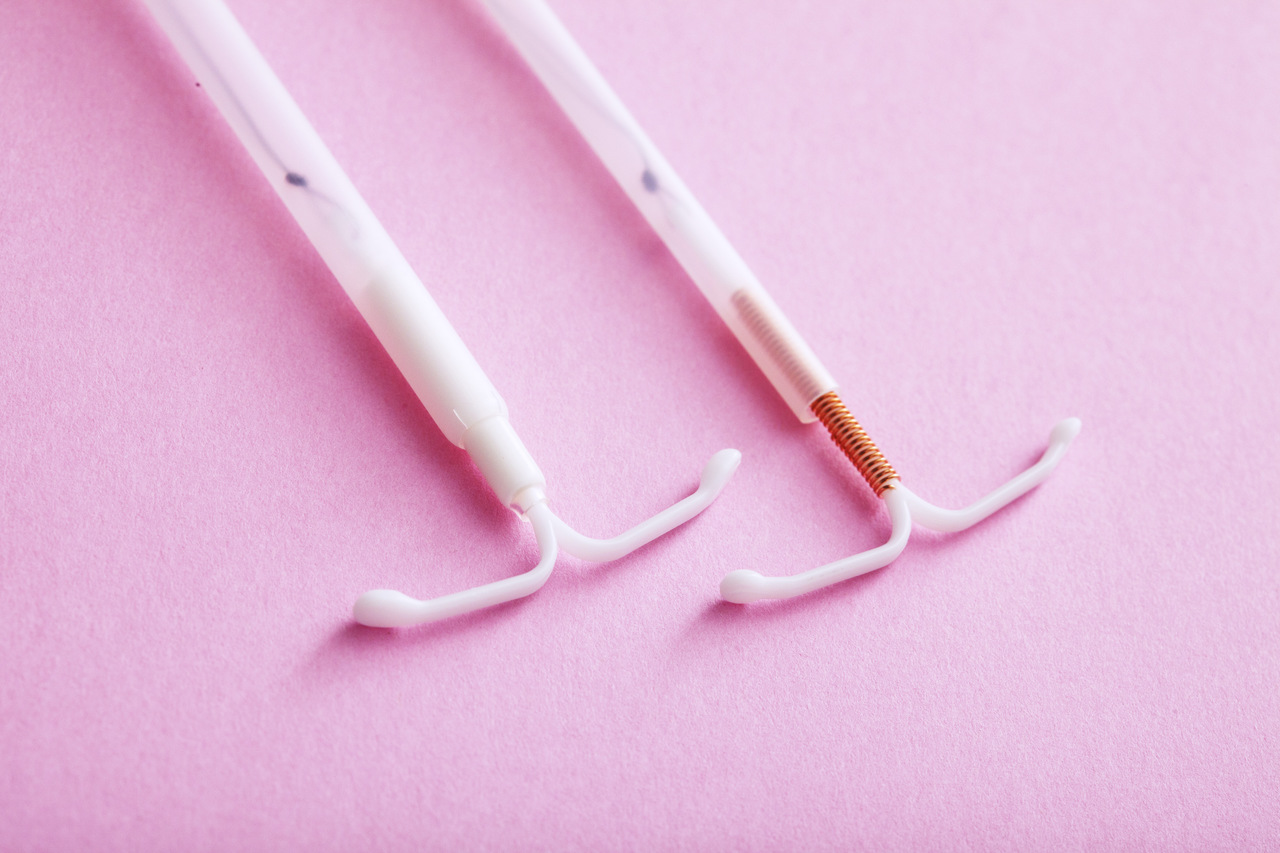 DIU: Tudo o que você precisa saber sobre o dispositivo intrauterino