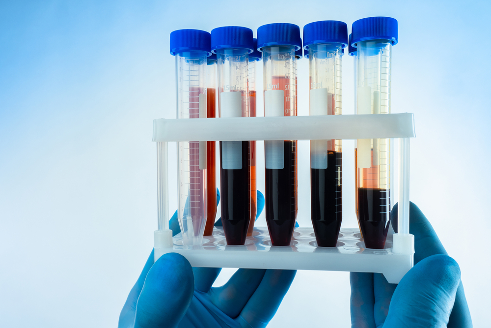 Tipos sanguíneos: quais são e qual a diferença entre eles