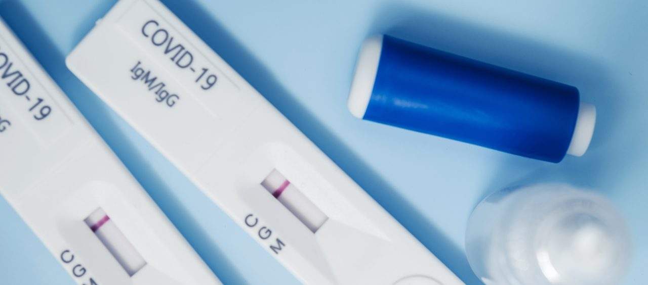 igG e IgM para Covid