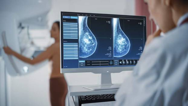 Mamografia: como é feito o exame e quem deve realizá-lo