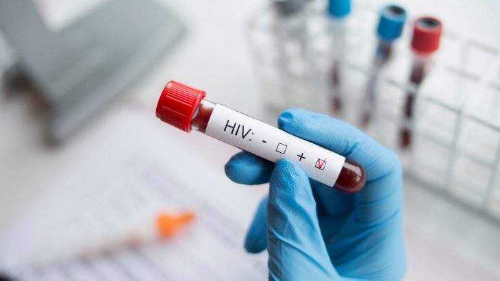 medidas profiláticas HIV