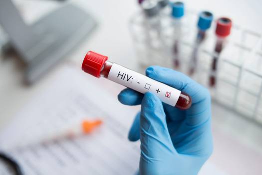 HIV tem medidas profiláticas para exposição de risco