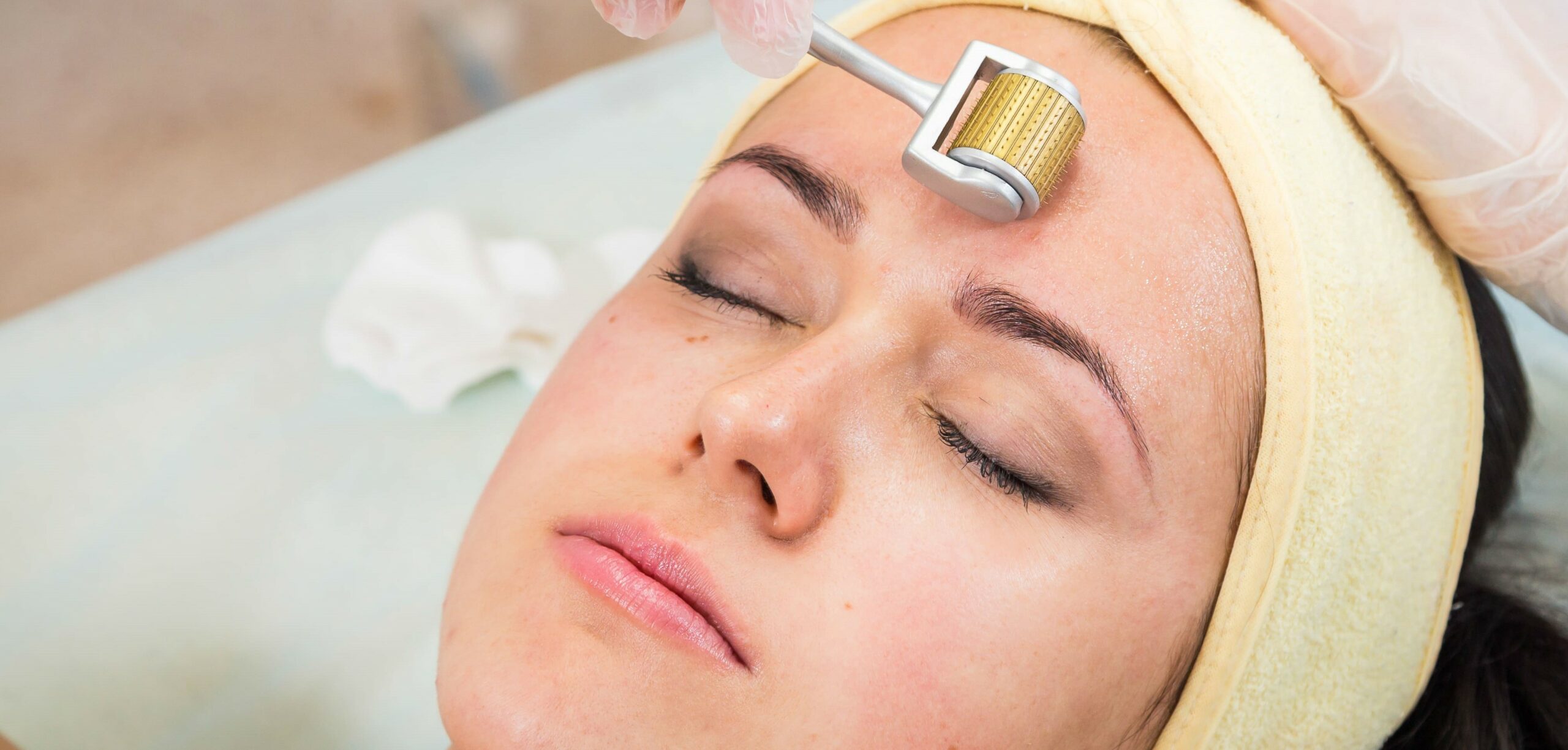 Dermaroller: o que é e quais são os benefícios