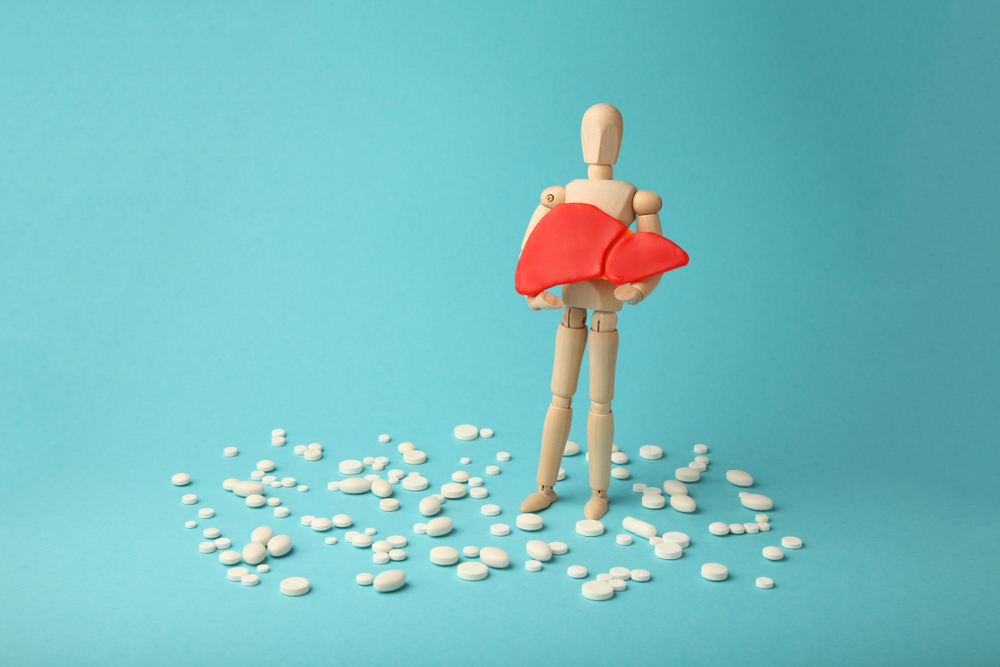 Hipertensão portal: o que é, sintomas e tratamento