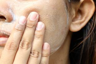 Dermoabrasão: o que é, como funciona e cuidados com a pele