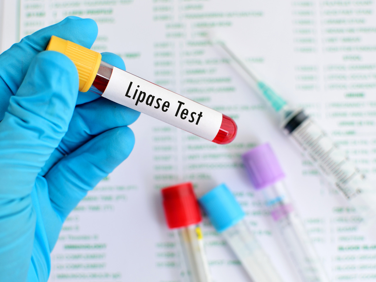 Lipase: o que é, para que serve o exame e resultados