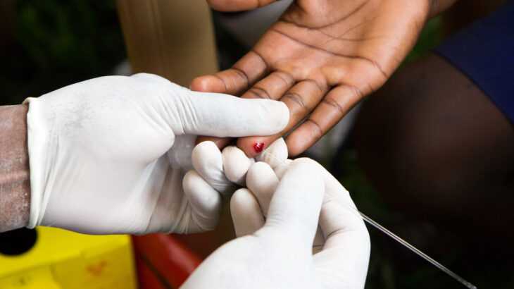 tratamento contra o HIV