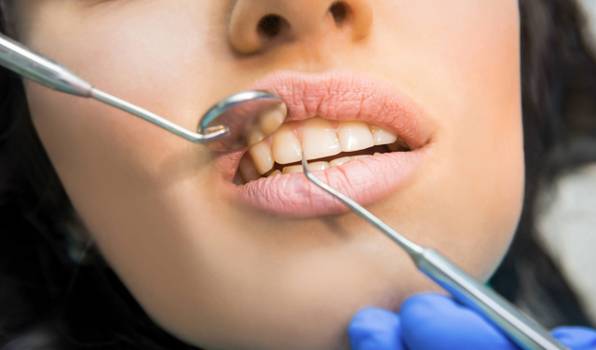 Milhões de brasileiros perderam dentes ao longo da vida: Por quê?