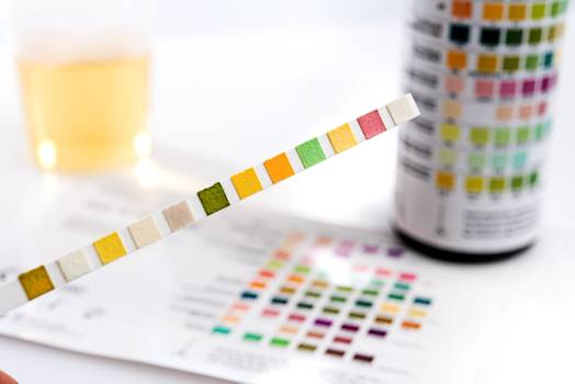 pH da urina: qual o correto e o que ele indica?