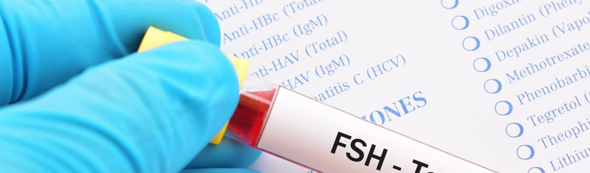 FSH: o que é, para que serve e porque fica alto ou baixo - Vitat