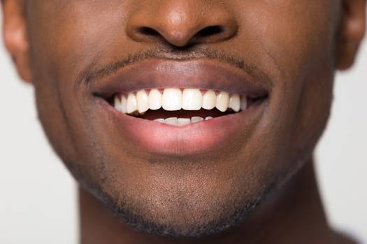 Prótese dentária: saiba quando é indicada e como manter a sua