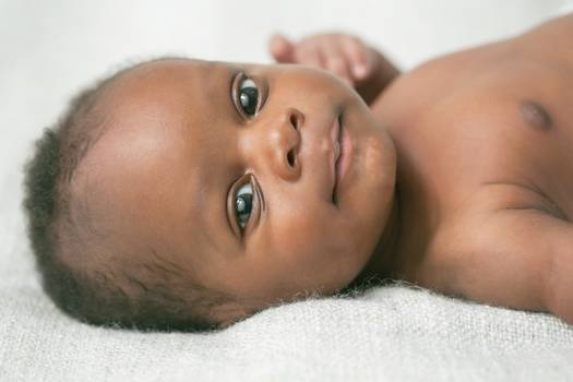 Retinopatia da prematuridade: o que é, causas e como tratar
