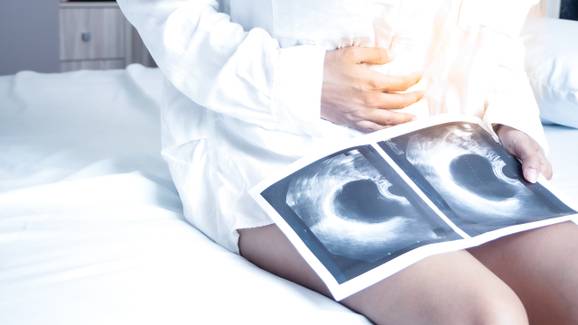 Histerossalpingografia: o exame que investiga infertilidade