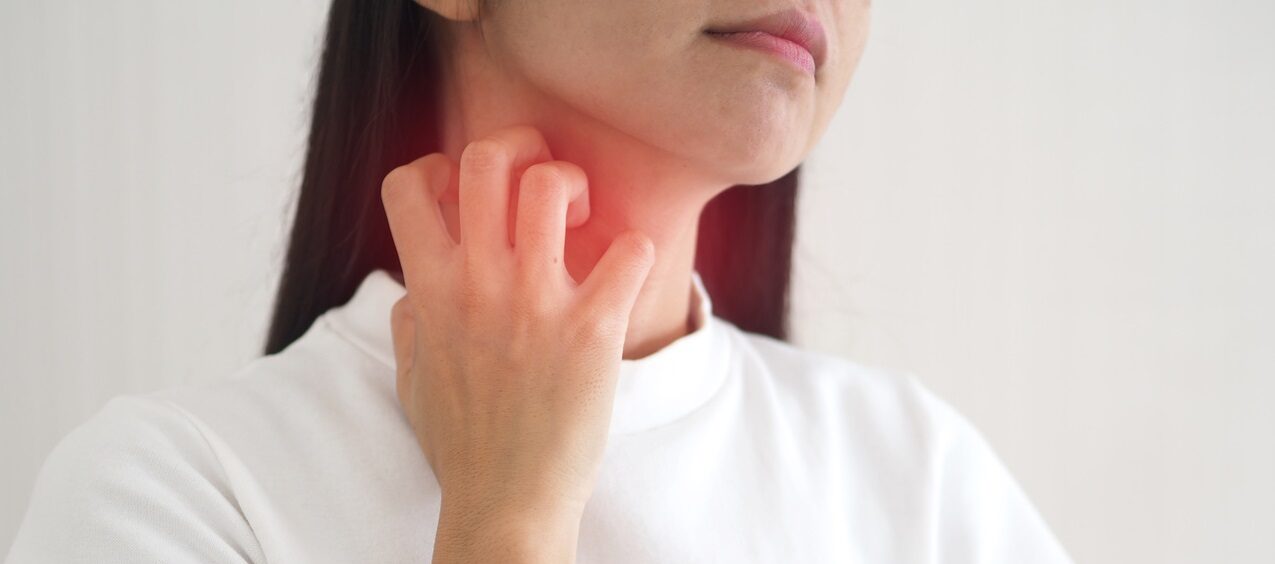 Urticária aquagênica