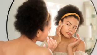 Manchas de acne podem afetar a saúde mental