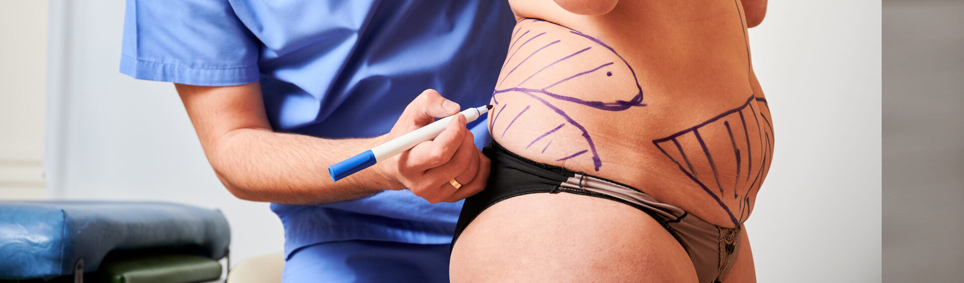 quem tem diabetes pode fazer plástica