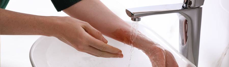 Queimadura na pele: quais cuidados caseiros realmente funcionam?