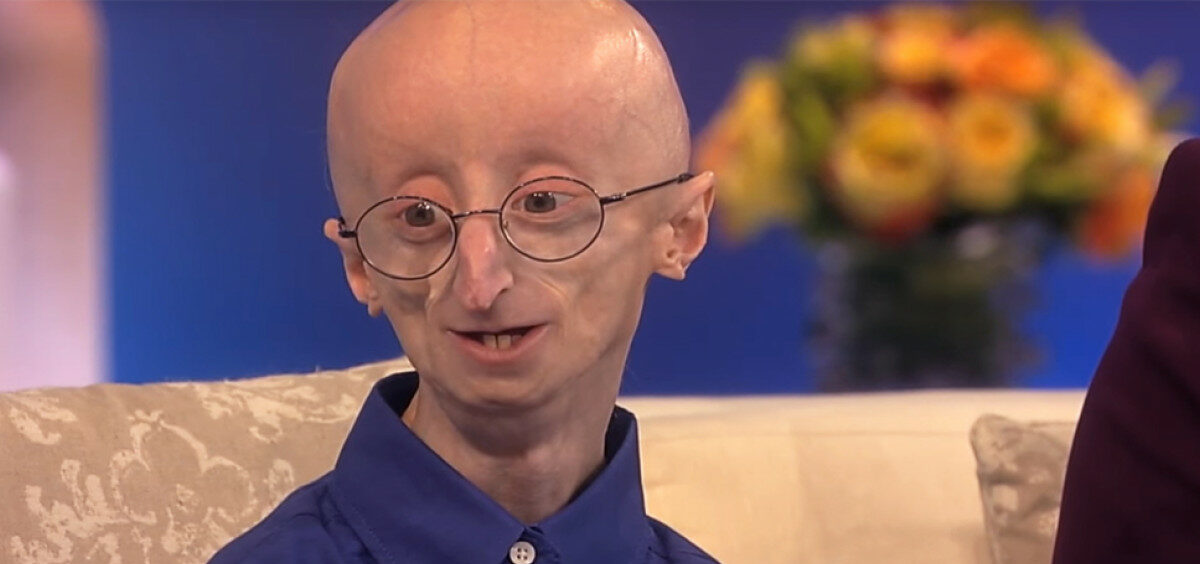 progeria