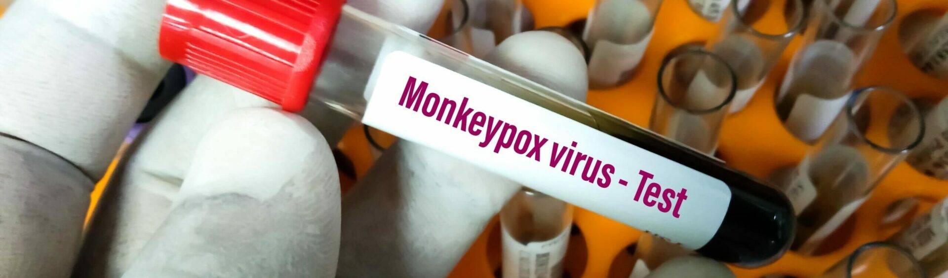surto de varíola dos macacos