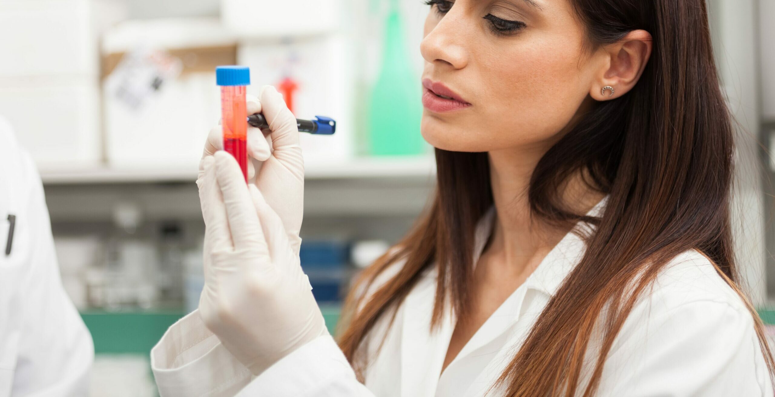 Exame VHS: O que é e quando fazer