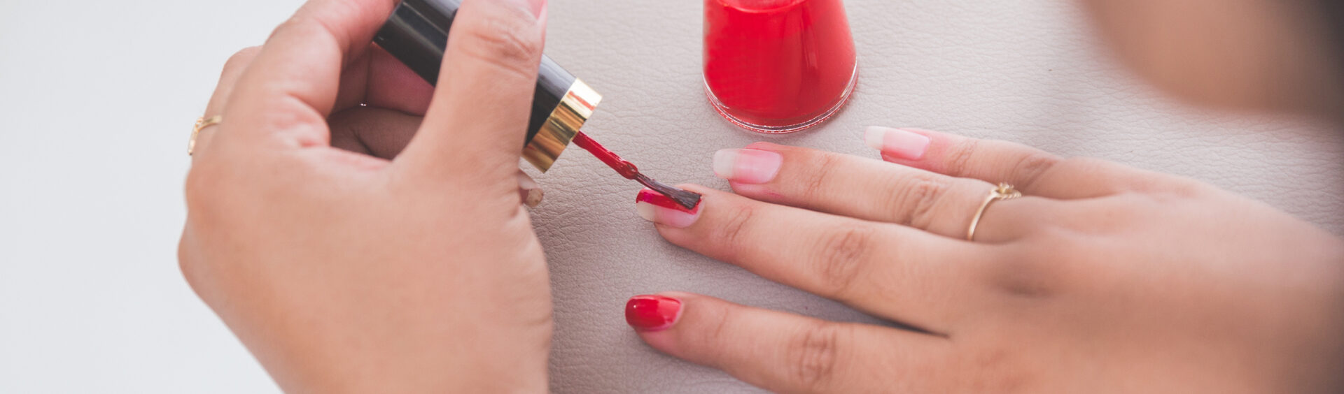 alergia a esmalte