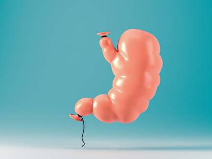 Balão intragástrico ou bariátrica: quais as indicações de cada procedimento?
