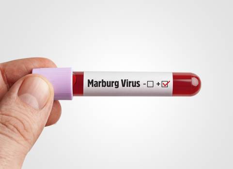 Marburg: OMS confirma surto do vírus primo do Ebola