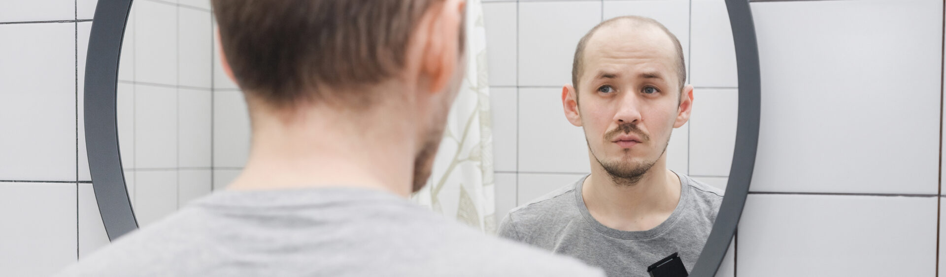 transplante de barba