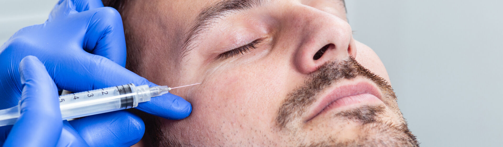 rejuvenescimento facial