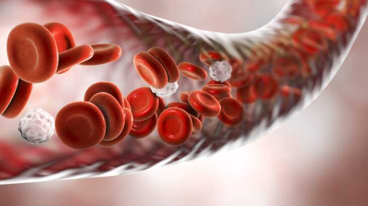 anemia hemolítica