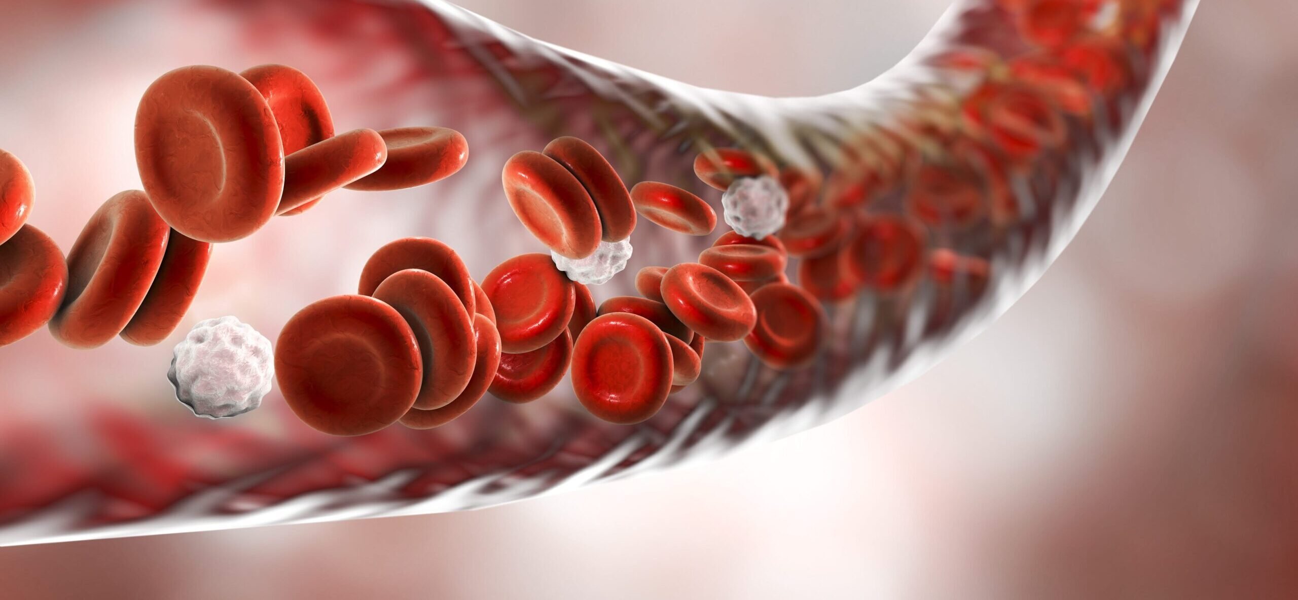 anemia hemolítica o que é principais sintomas e tratamento vitat