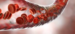 Anemia hemolítica: o que é, principais sintomas e tratamento