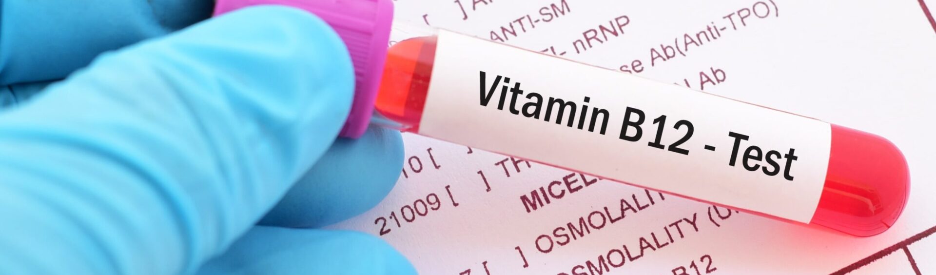 anemia megaloblástica