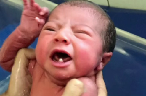 Bebê nasceu com dois dentes e viralizou na internet: entenda o caso