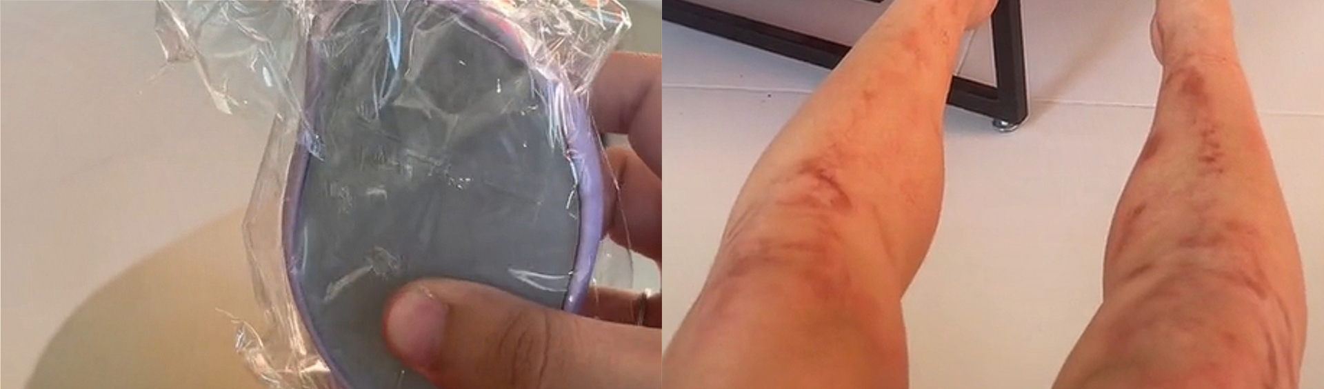 Depilador de cristal: método que viralizou na web é arriscado, diz médica