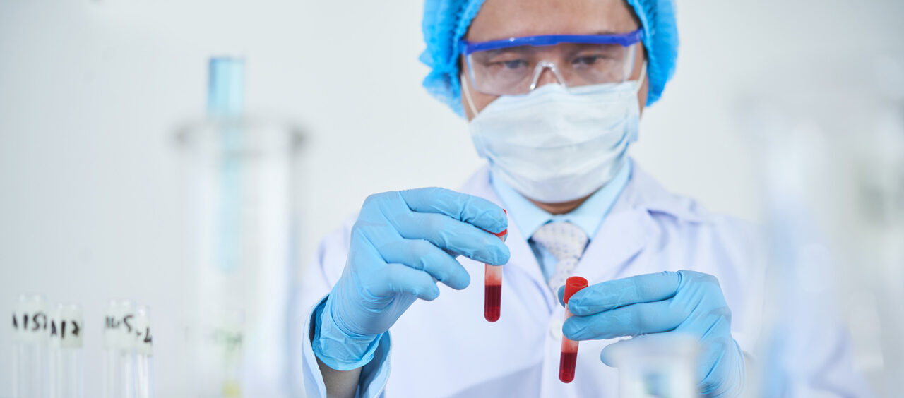 prEP HIV
