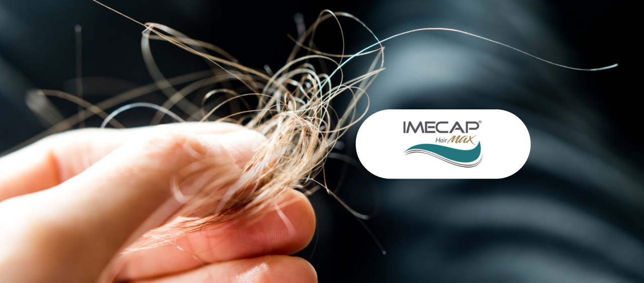 queda de cabelo