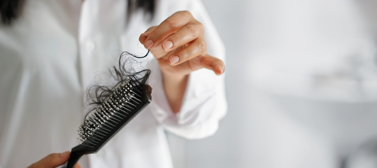 Queda de cabelo e síndrome dos ovários policísticos: qual é a relação?