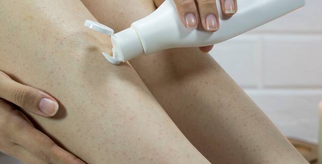 Strawberry legs: o que são e como evitar os pontinhos pretos que surgem na pele depois da depilação