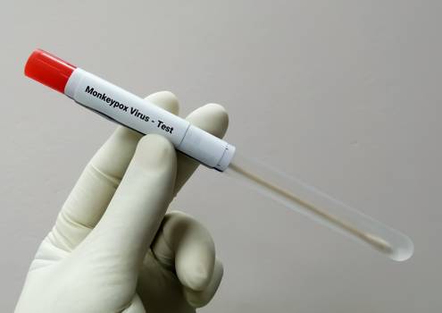 Teste da monkeypox: Anvisa aprova kit produzido pela Fiocruz