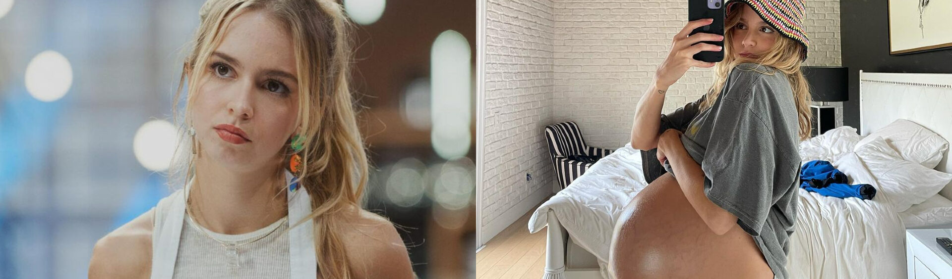 tratamento para flacidez