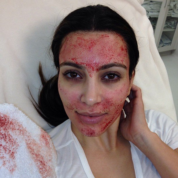 sangue no rosto de Kim Kardashian