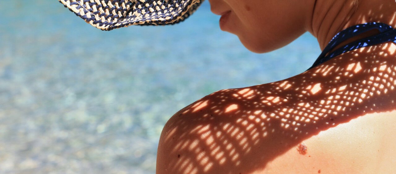 Carcinoma espinocelular