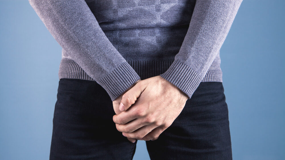 varicocele