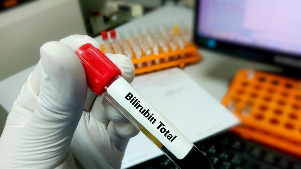 bilirrubina no sangue