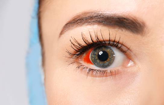 Derrame ocular: o que causa o “sangue nos olhos” em algumas pessoas?