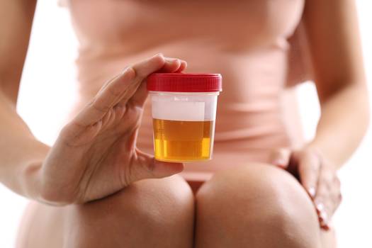 Erros no exame de urina: confira os mais comuns e como evitá-los