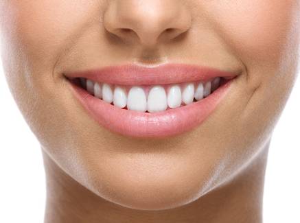 Facetas dentárias: o que você precisa saber antes de colocá-las